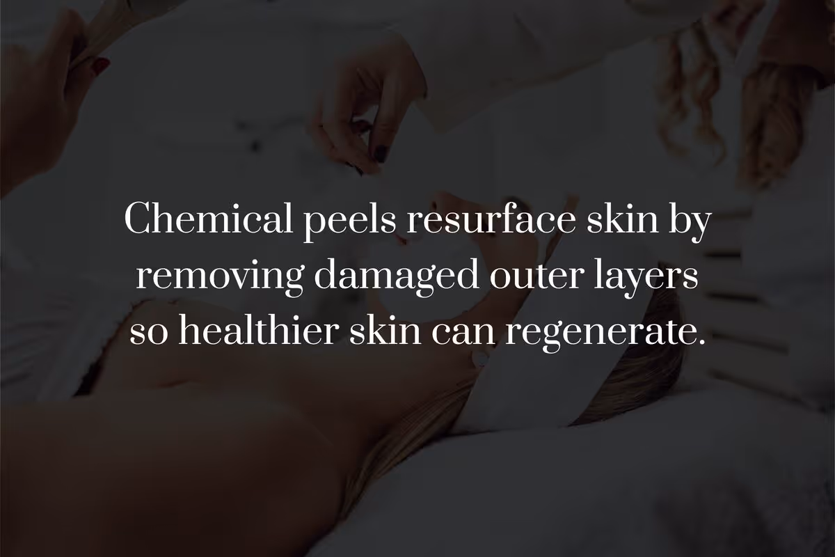 What Is a Chemical Peel?