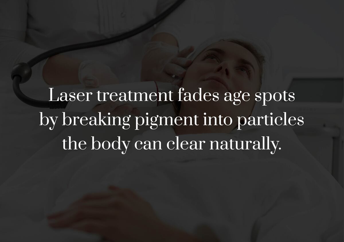How Does Laser Energy Target Age Spots?
