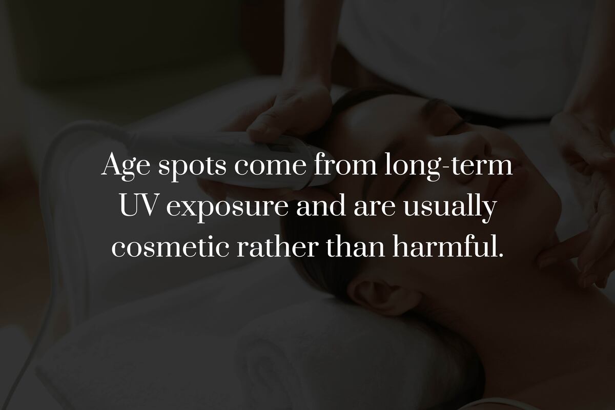 What Are Age Spots?