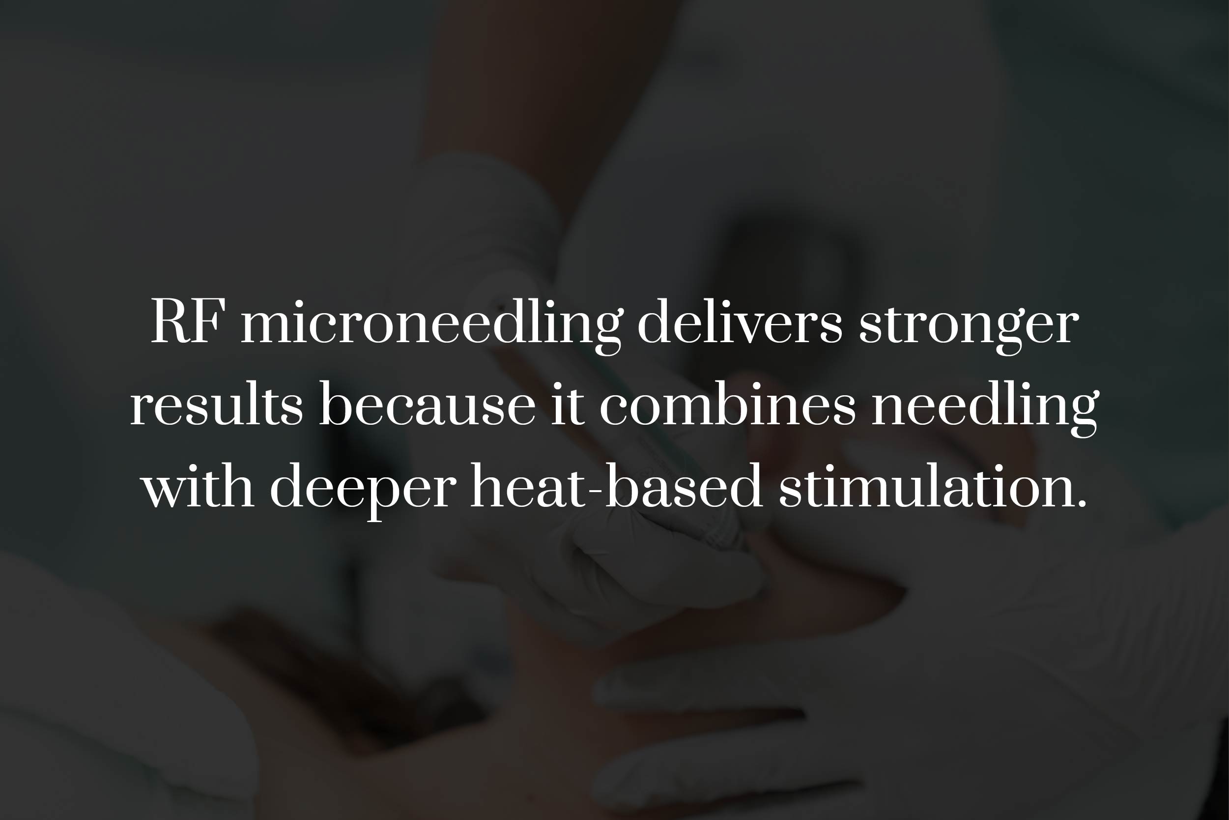 What Is the Difference Between RF and Standard Microneedling?
