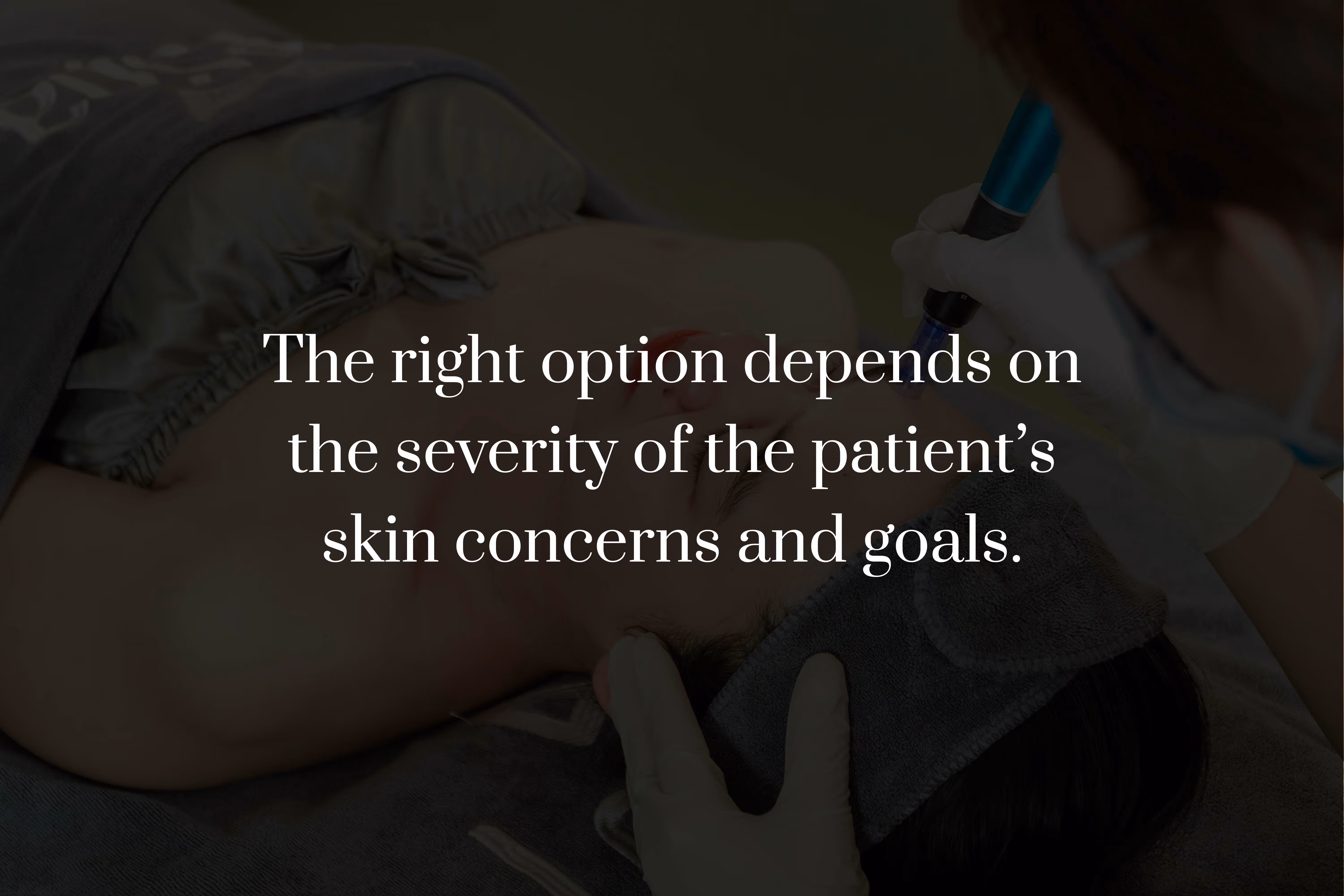 Which Microneedling Treatment Is Right for Your Skin?