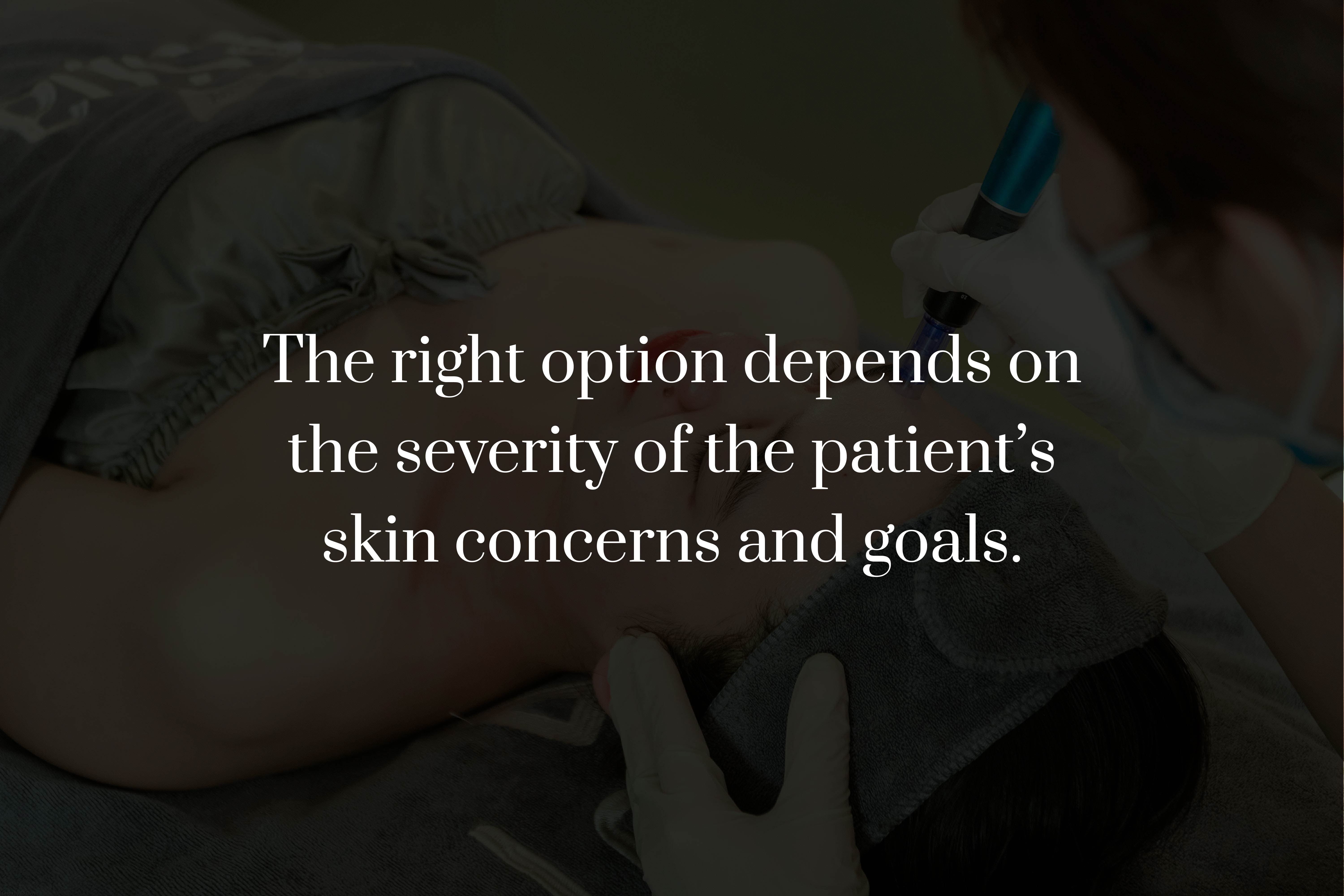 Which Microneedling Treatment Is Right for Your Skin?