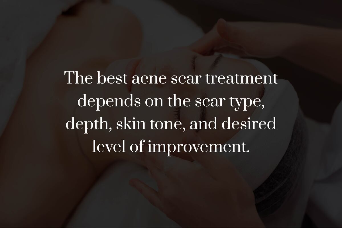 What Are the Most Effective Treatments for Acne Scars?