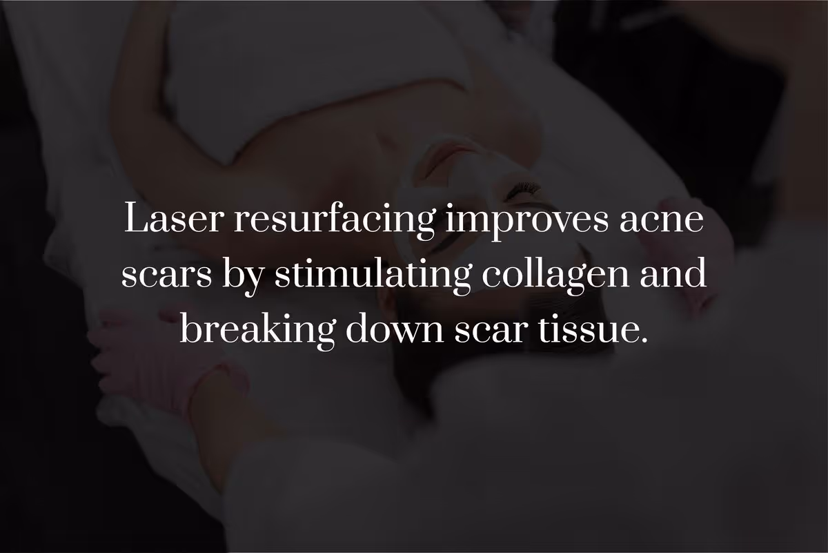 How Does Laser Resurfacing Treat Acne Scars?