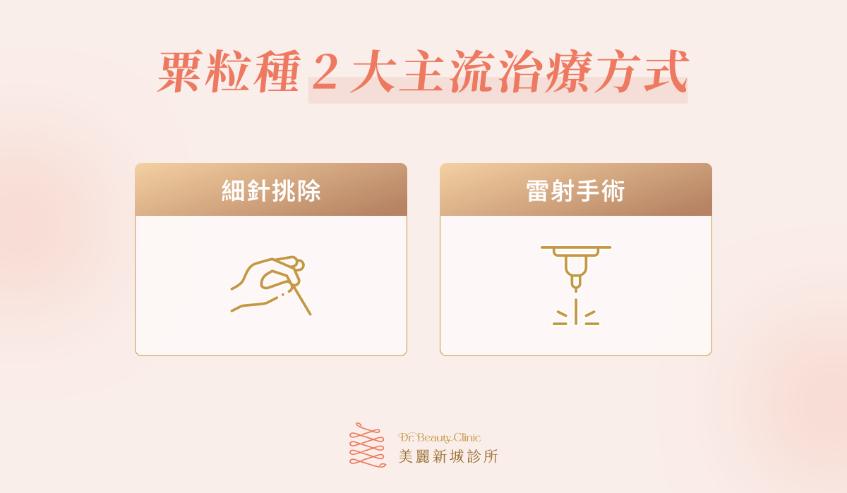 粟粒腫2 大主流治療方式