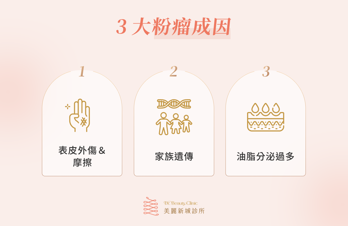 3 大粉瘤成因