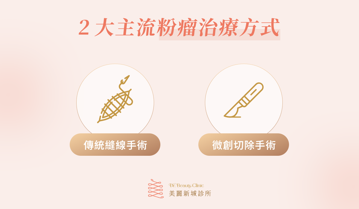 2 大主流粉瘤治療方式