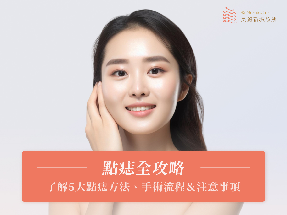 點痣全攻略:了解5大點痣方法、手術流程&注意事項,除掉惱人的痣