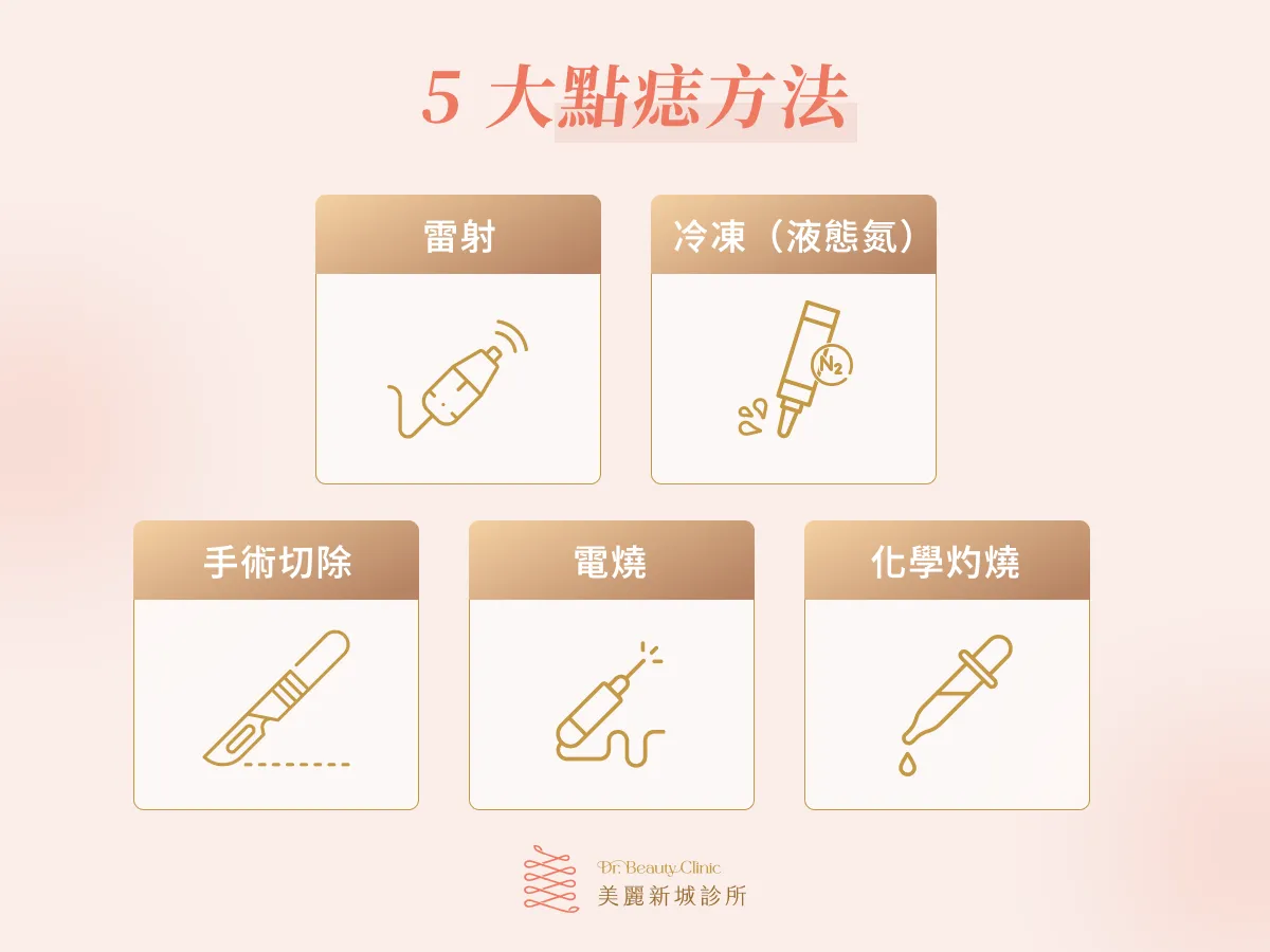 5 大點痣方法