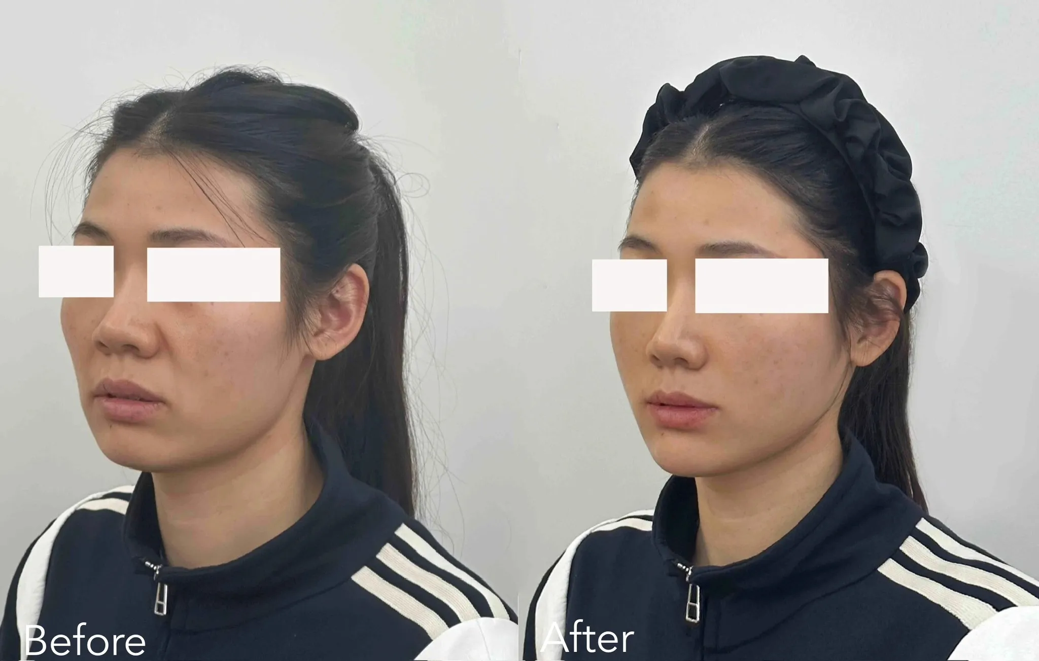 MINT 神力拉提案例見證 — 美麗新城診所