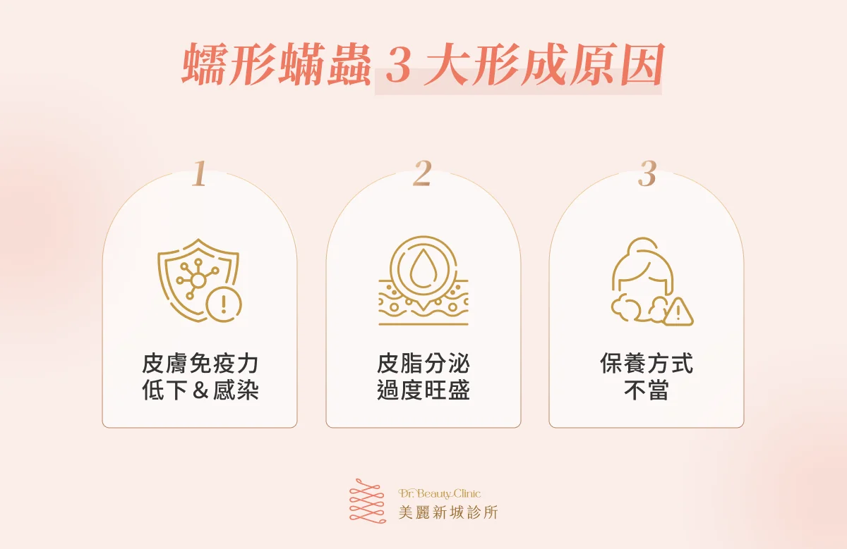 蠕形蟎蟲3大形成原因