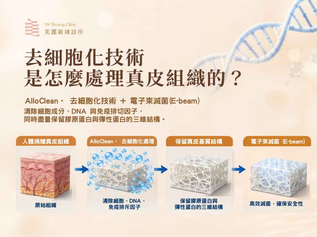 去細胞化技術怎麼處理真皮組織