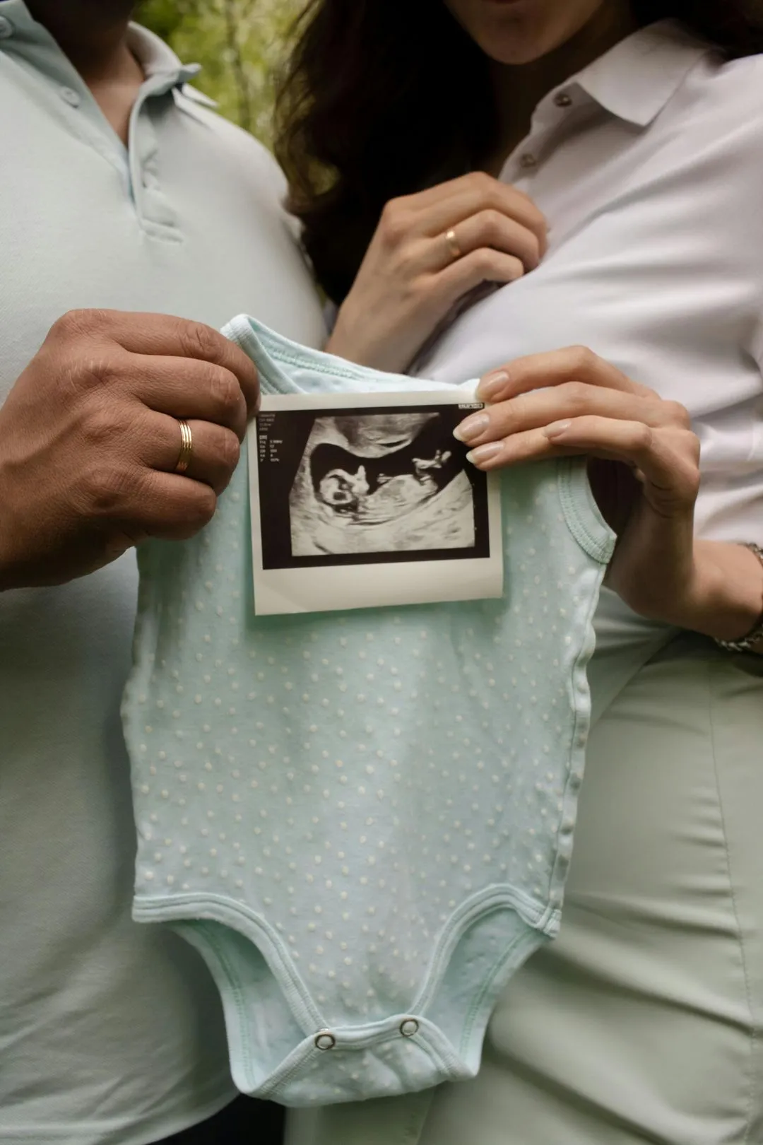 Emotionales Pregnancy Announcement mit gerahmtem Ultraschallbild, Trockenblumen und Babybodys – liebevoll dekoriert von Babybloom Wien