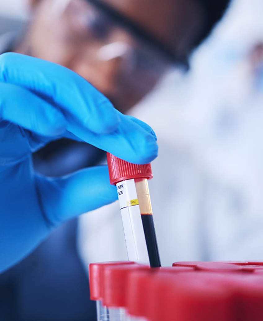 Blood sample analysis