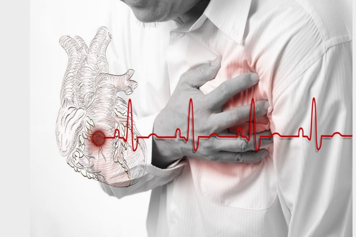 The Silent Heart Attack: Why Many People Ignore the Warning Signs Until It Is Too Late