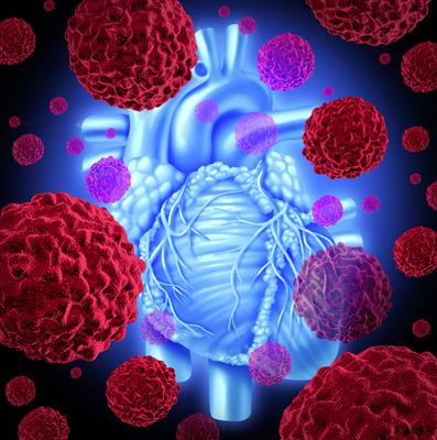 Cardio-Oncology in Cyprus | Heart Care During Cancer Treatment