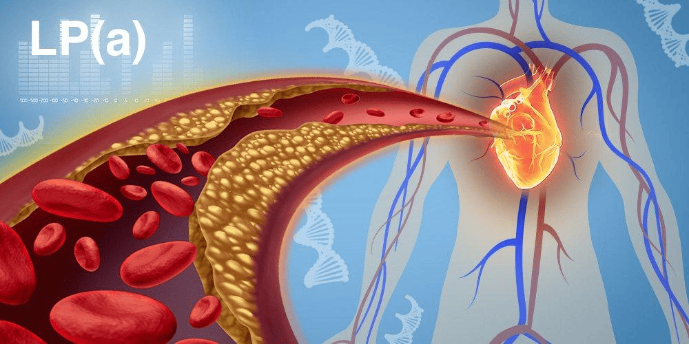 Comparison of LDL cholesterol, ApoB and Lipoprotein(a) in cardiovascular risk assessment