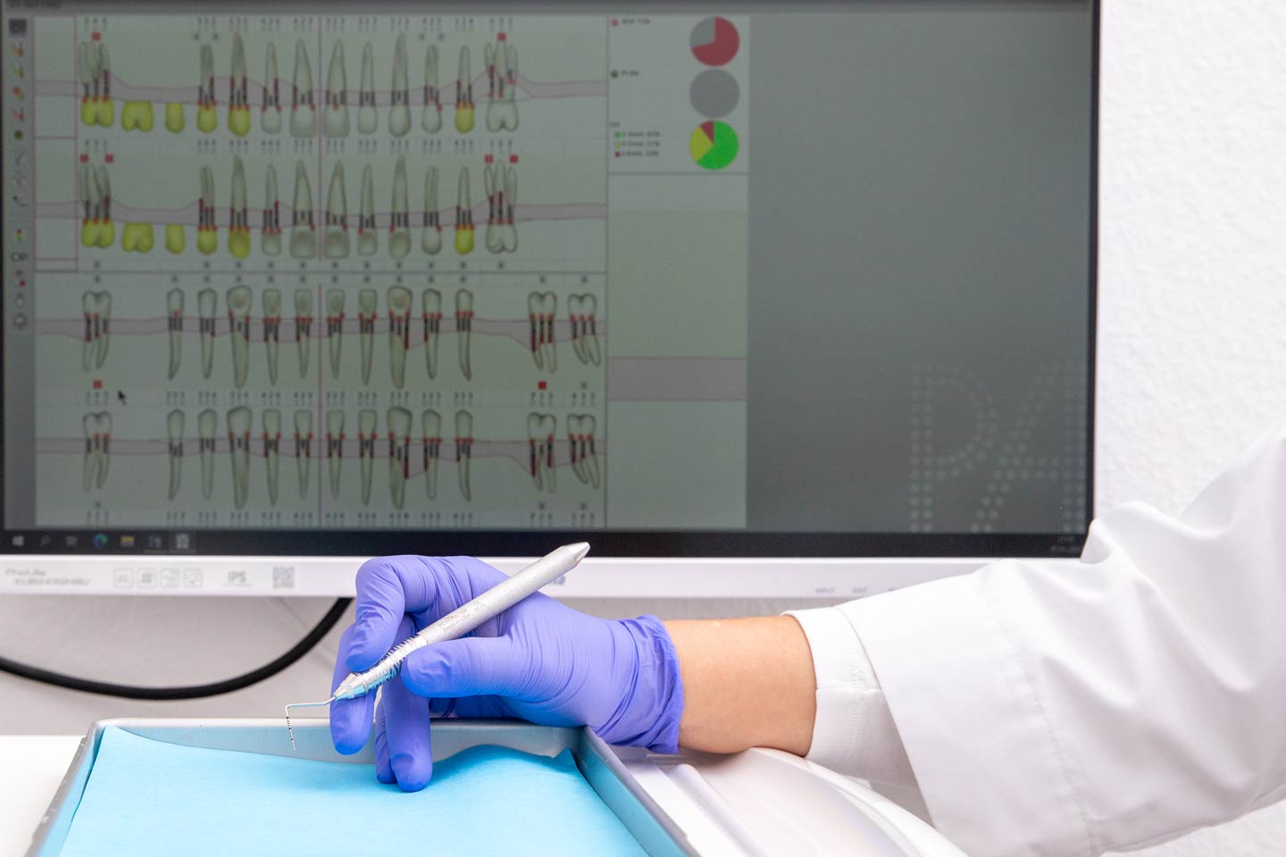Hand einer Zahnärztin mit Werkzeug vor einem Monitor