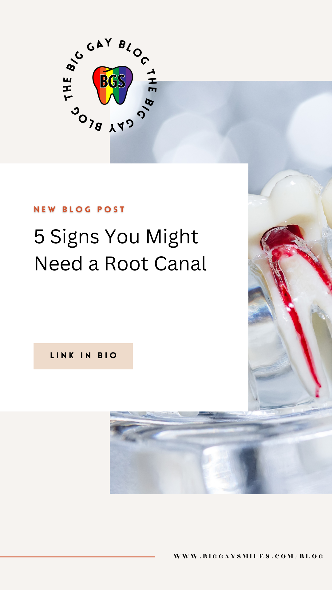 5 Signs You Might Need a Root Canal