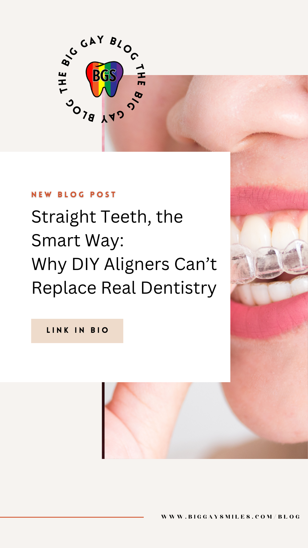 Straight Teeth, the Smart Way: Why DIY Aligners Can’t Replace Real Dentistry.
