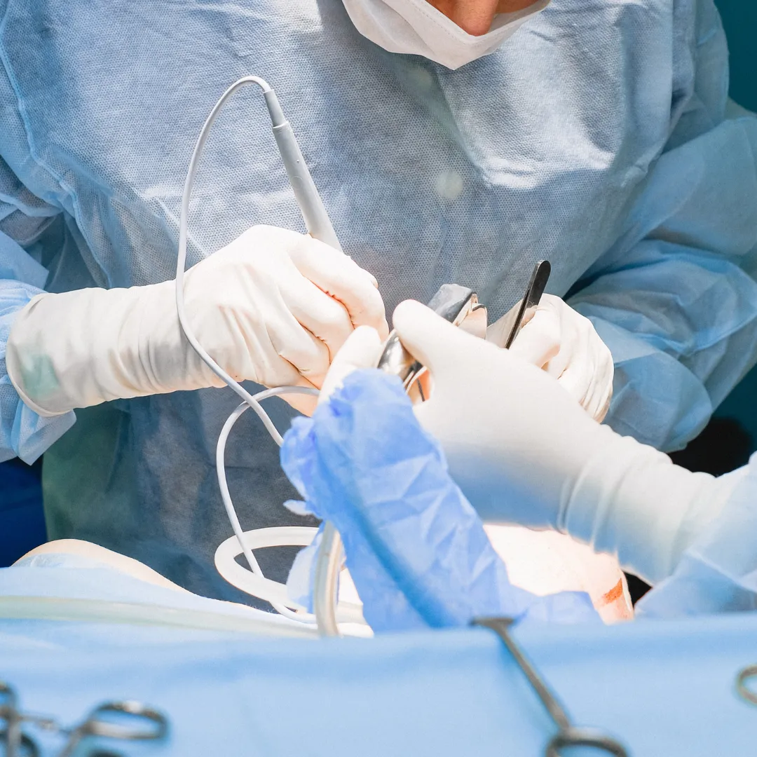 Bone Anchorage Devices