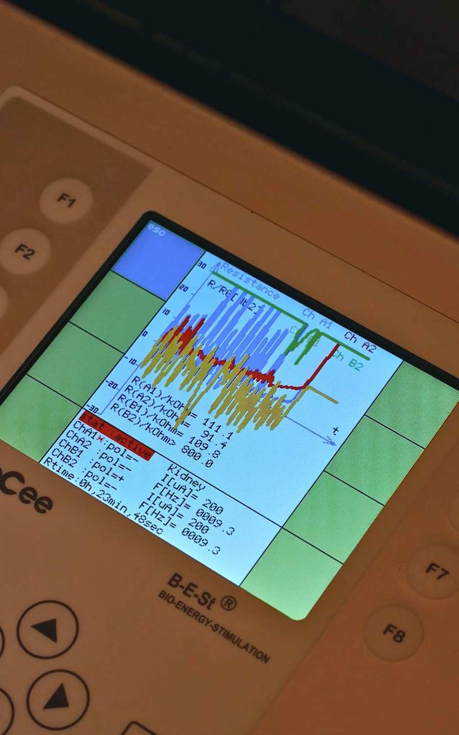 Close-up of the B-E-St microcurrent therapy device displaying treatment settings for cellular repair, ATP production, and muscle recovery in Dubai.