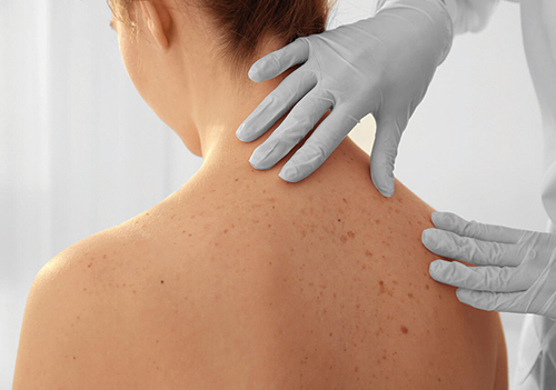 Een vrouw met ontblote rug wordt onderzocht door een arts met handschoenen.