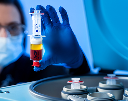 Een arts met blauwe handschoenen houdt een dubbele ACP-spuit in de hand.