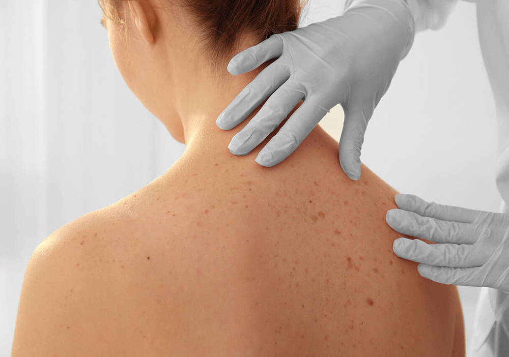 Een vrouw met ontblote rug wordt onderzocht door een arts met handschoenen.