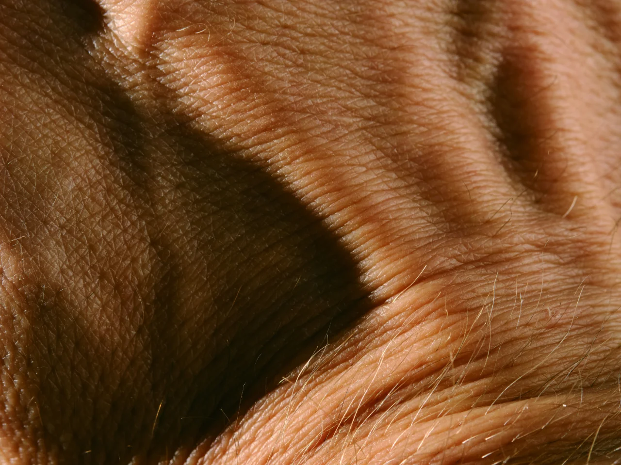 Close-up of an orange cat's fur, where dandruff flakes collect along the back