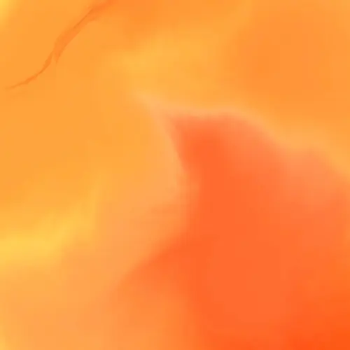 Vitamin-C-Infusion in Berliner Praxis – hochdosiertes Vitamin C kann das Immunsystem stärken und Zellen vor oxidativem Stress schützen.