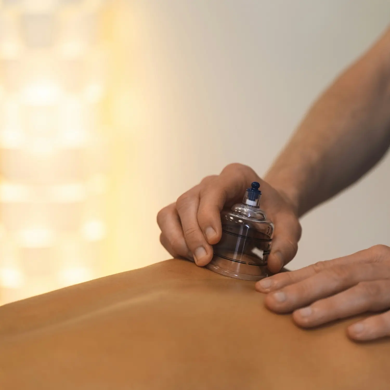 Schröpftherapie in Berlin – Schröpfgläser auf dem Rücken für Muskelentspannung