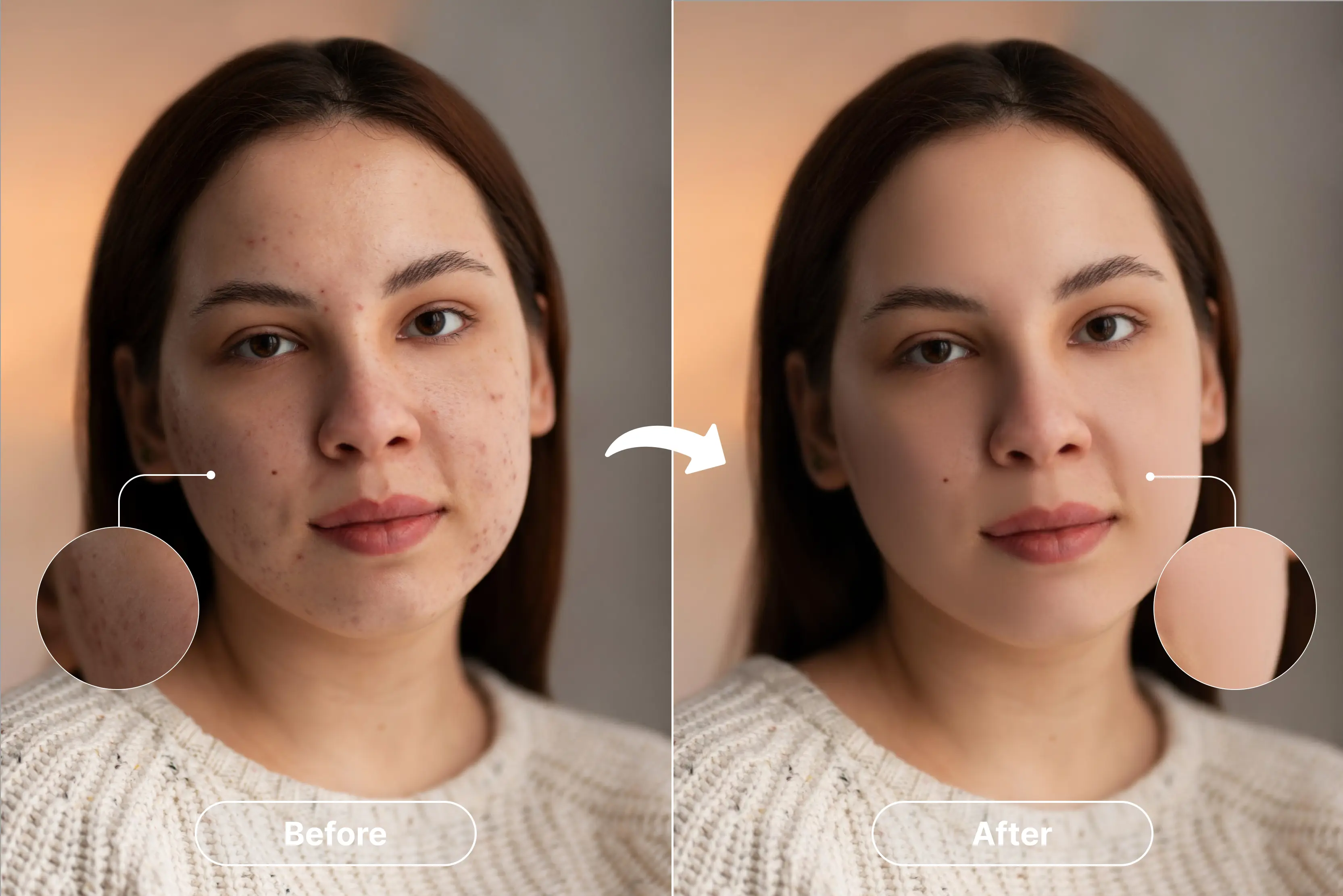 How to use a blemish remover tool