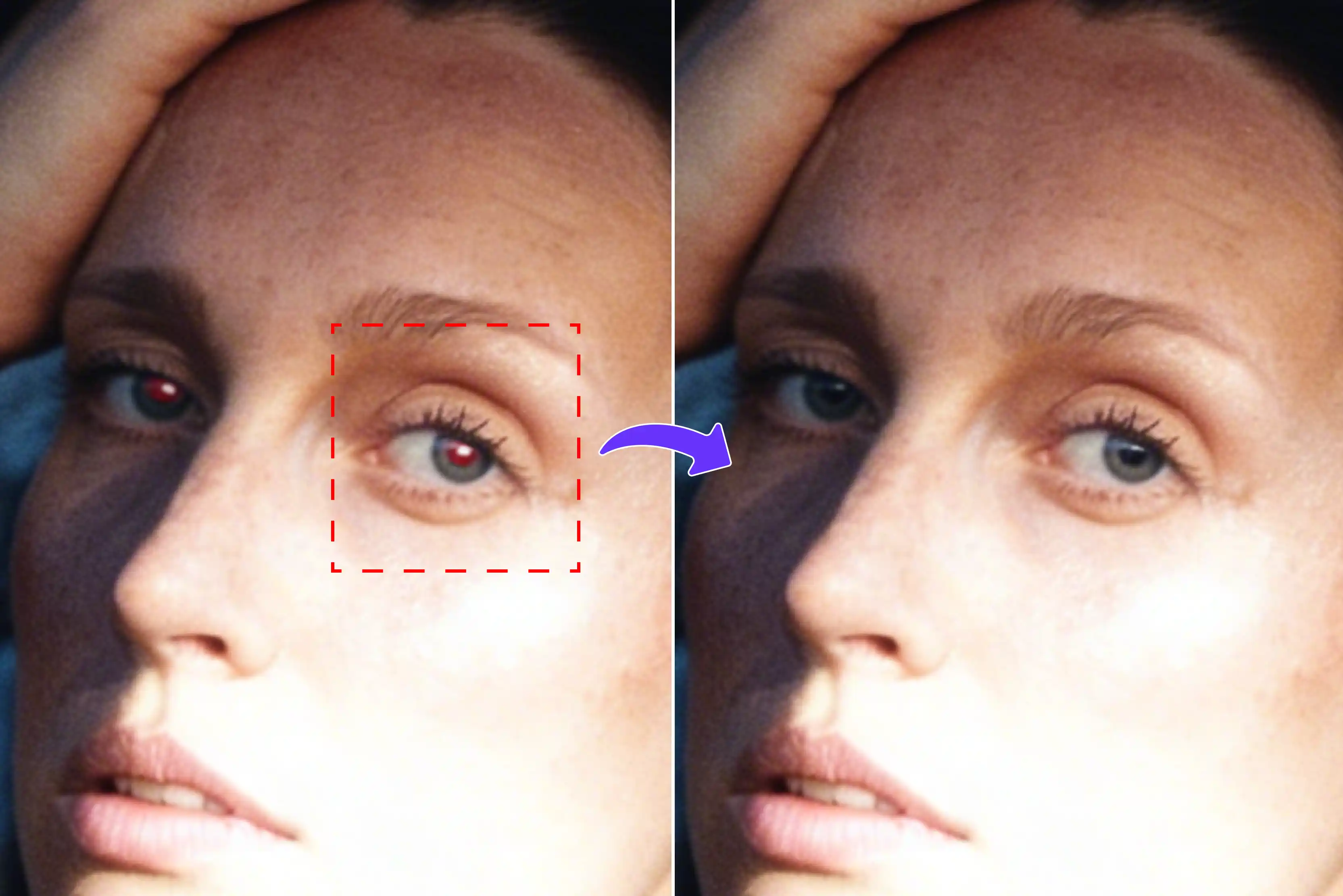 Best red eye remover tools