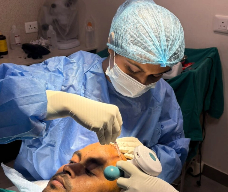 Hair Transplant Receding Hairline