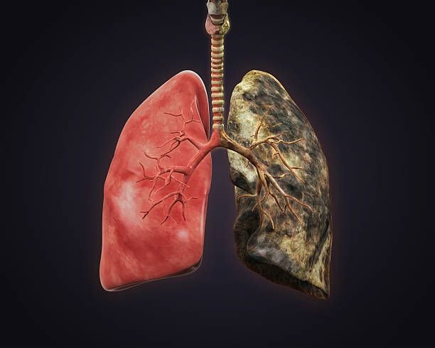 An illustration showing the physical health consequences of cough syrup misuse, including liver and respiratory issues.