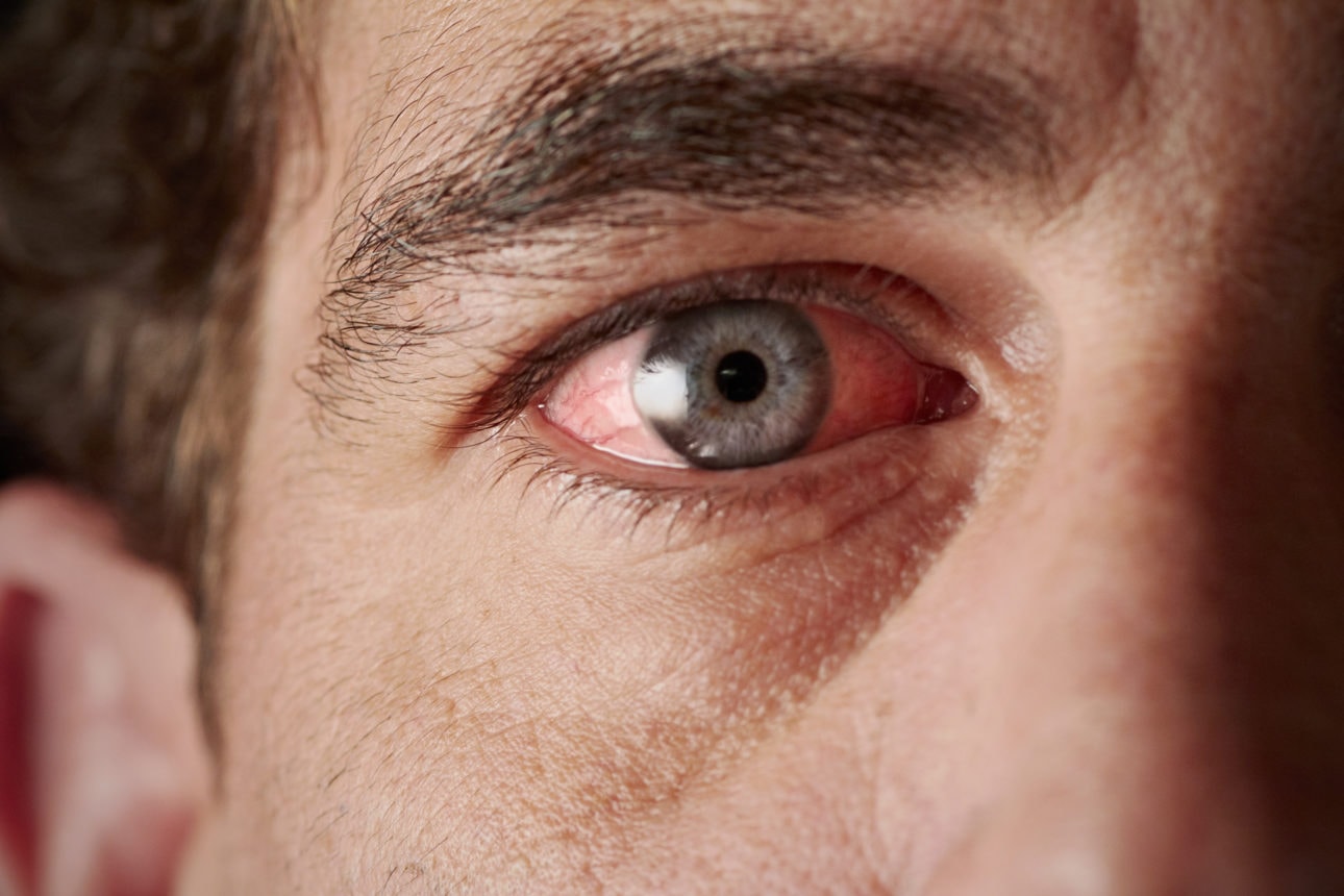 An illustration showing the impact of opioids on eye health, focusing on opioid receptors and eye health.
