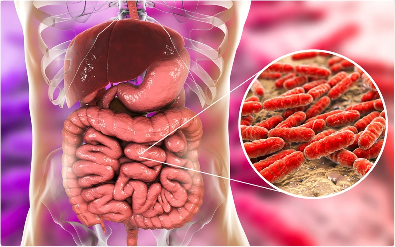 An illustration depicting how Suboxone alters the gut microbiome, with a blurred Suboxone film in the background.