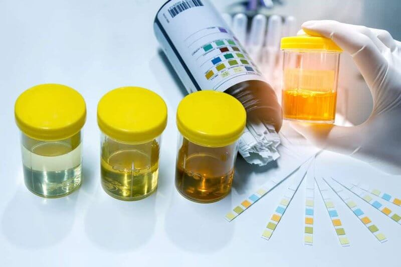 Different types of UA tests and what they detect.