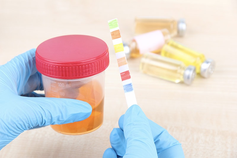 Pros and cons of remote drug testing.