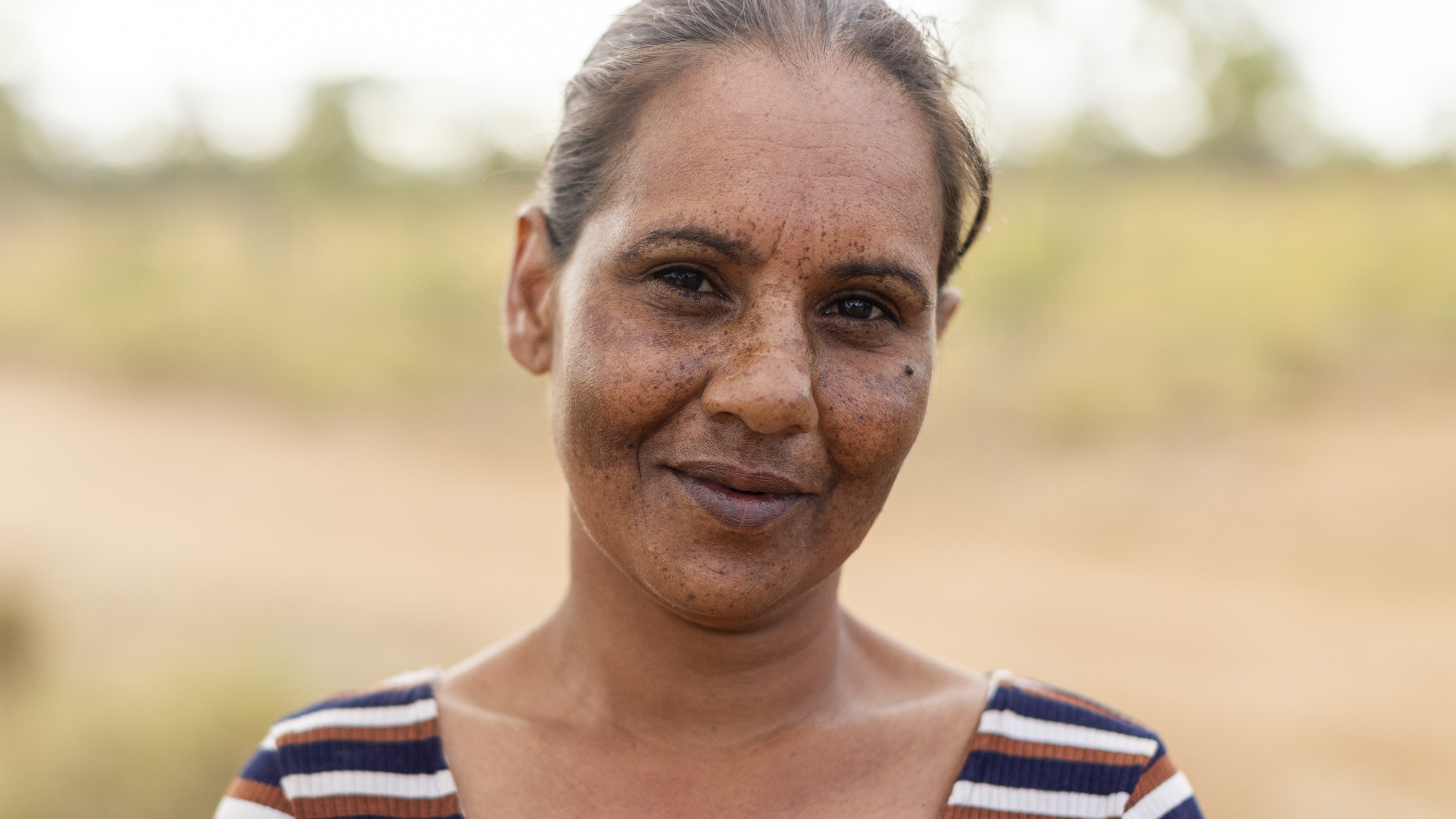 Close-up of a smiling woman with freckles wearing a striped top against an outdoor blurred background.