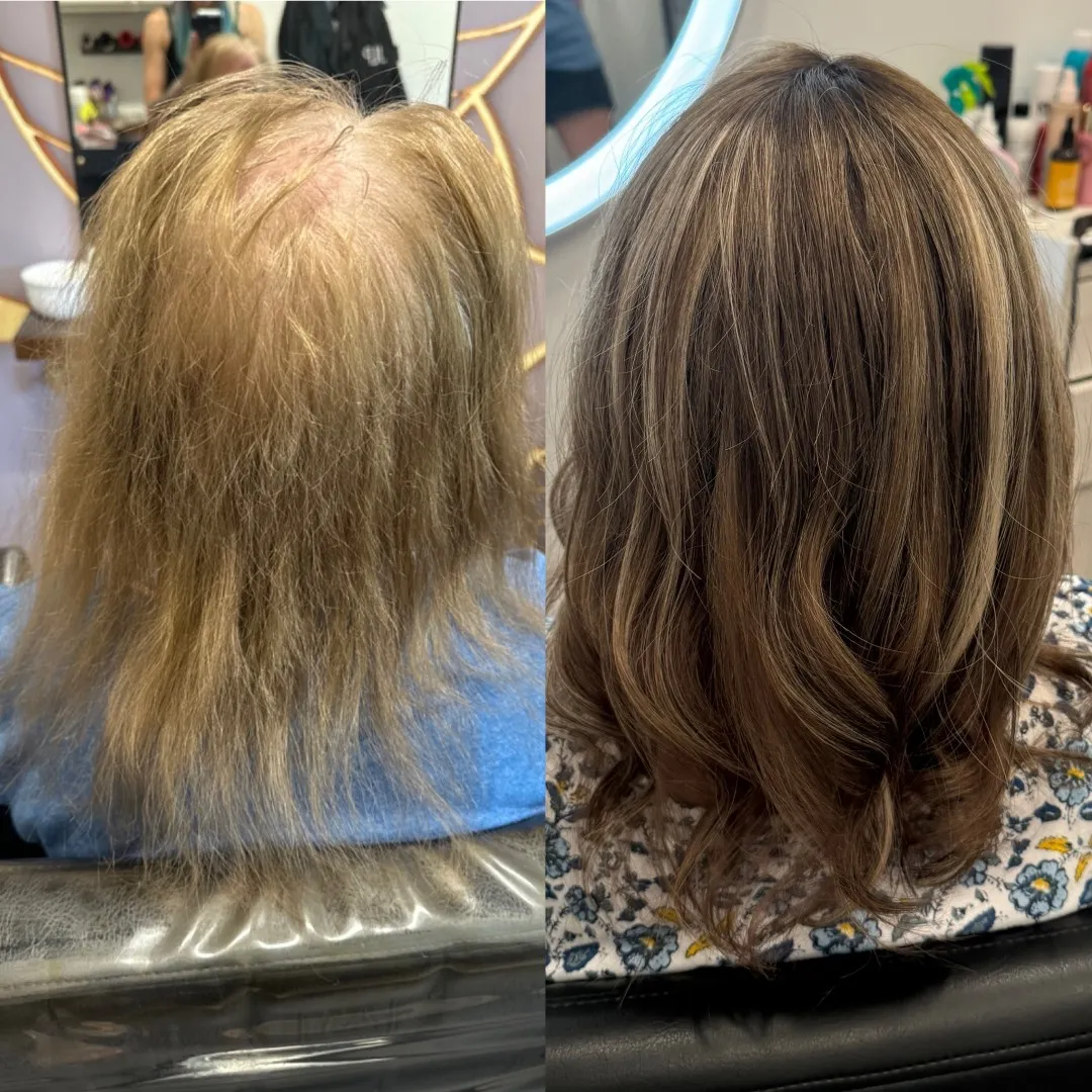 Before and after a hair topper for thinning hair
