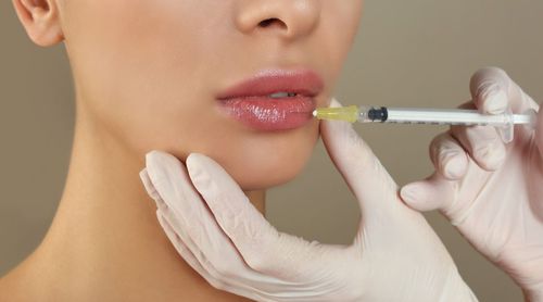 Lèvres précises et élégantes grâce à Yvoire