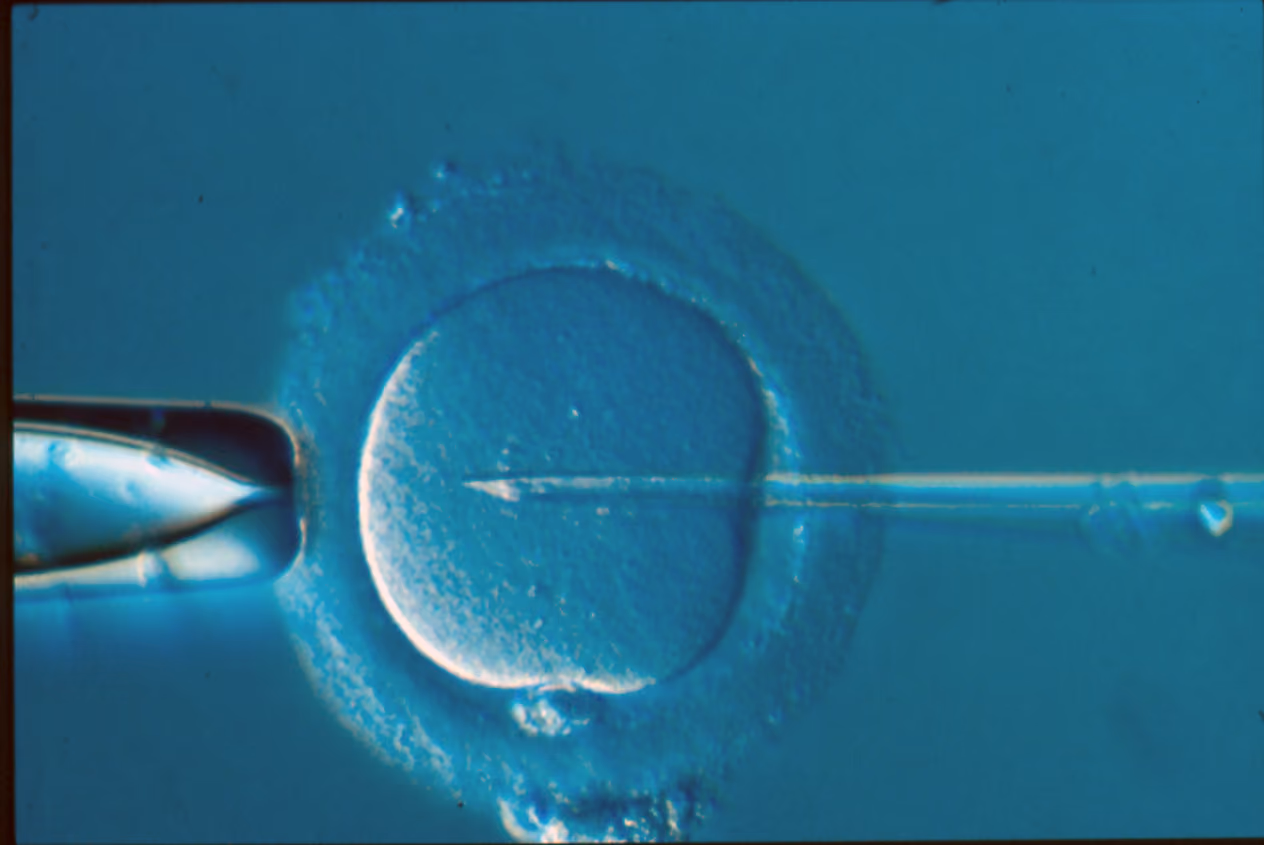A World-First in IVF: What Fully Automated ICSI Could Mean for Men and the Future of Fertility