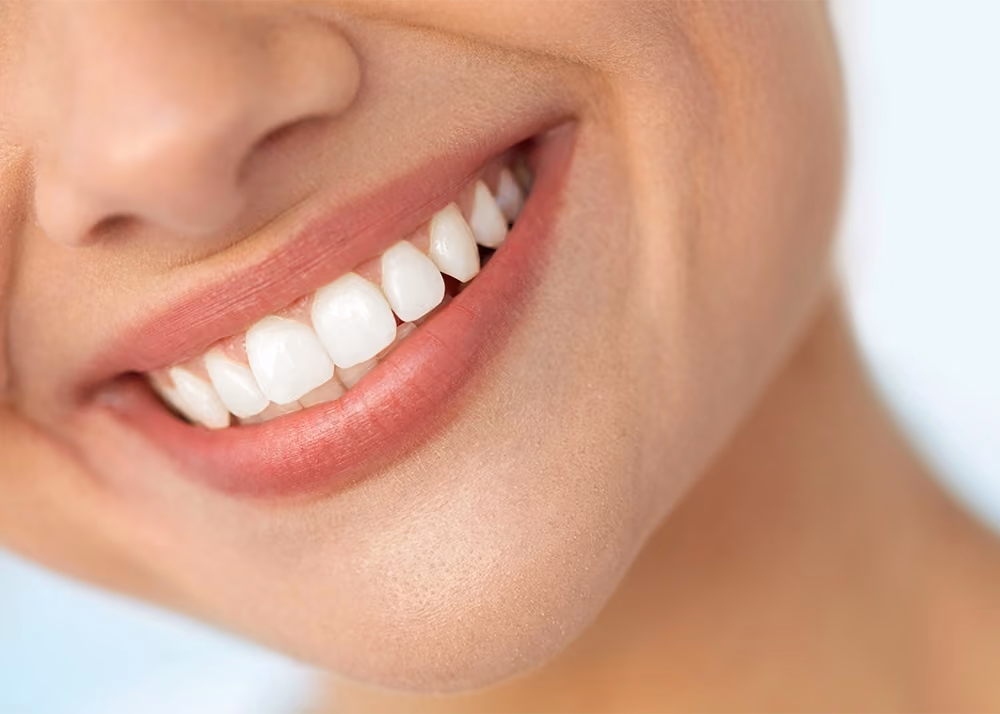 Close-up of woman's beautiful smile with healthy teeth and gums in San Francisco