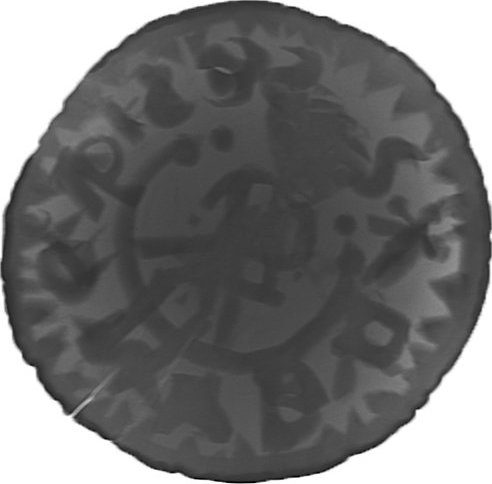 RTG snímek
