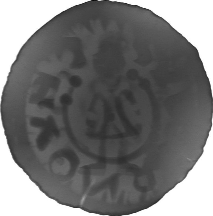 RTG snímek