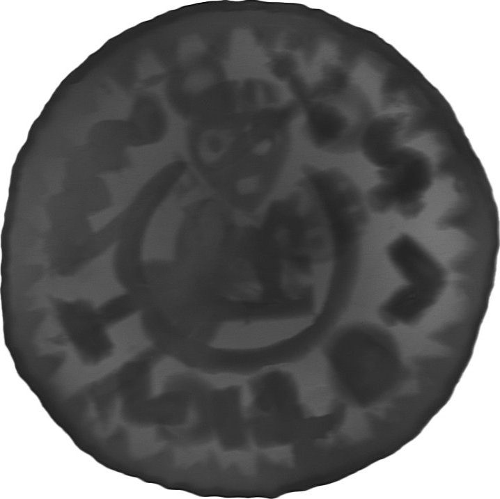 RTG snímek