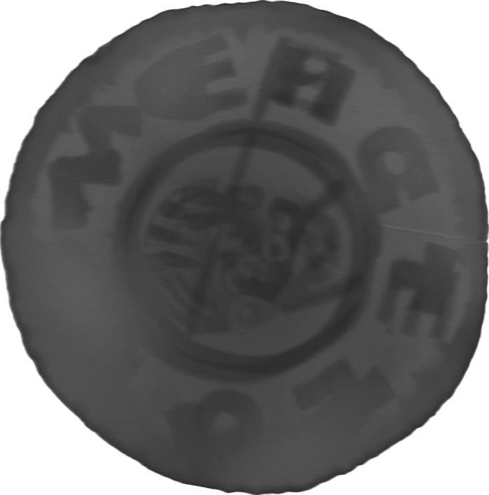 RTG snímek