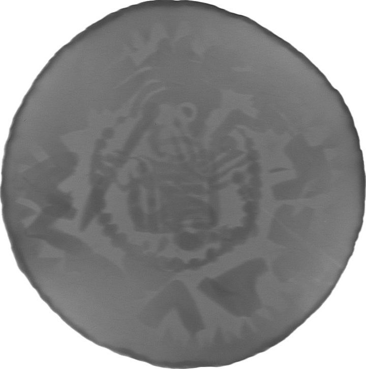 RTG snímek